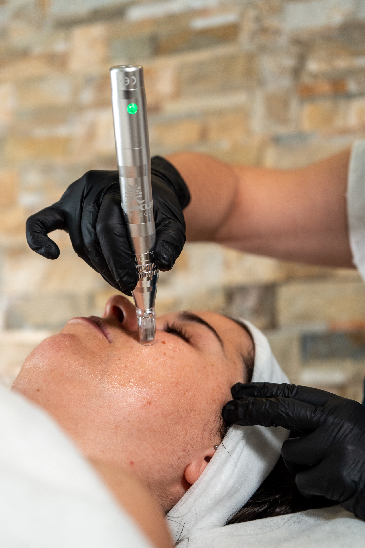 Microneedling / Dermapen